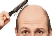 عوامل موثر بر طاسی زودهنگام
