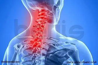 دیسک گردن و درمان آن با فیزیوتراپی
