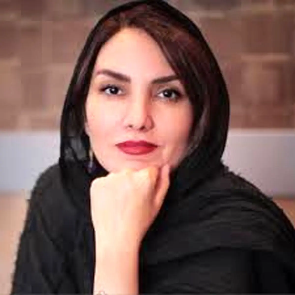 زخمی شدن سر بازیگر معروف / عکس
