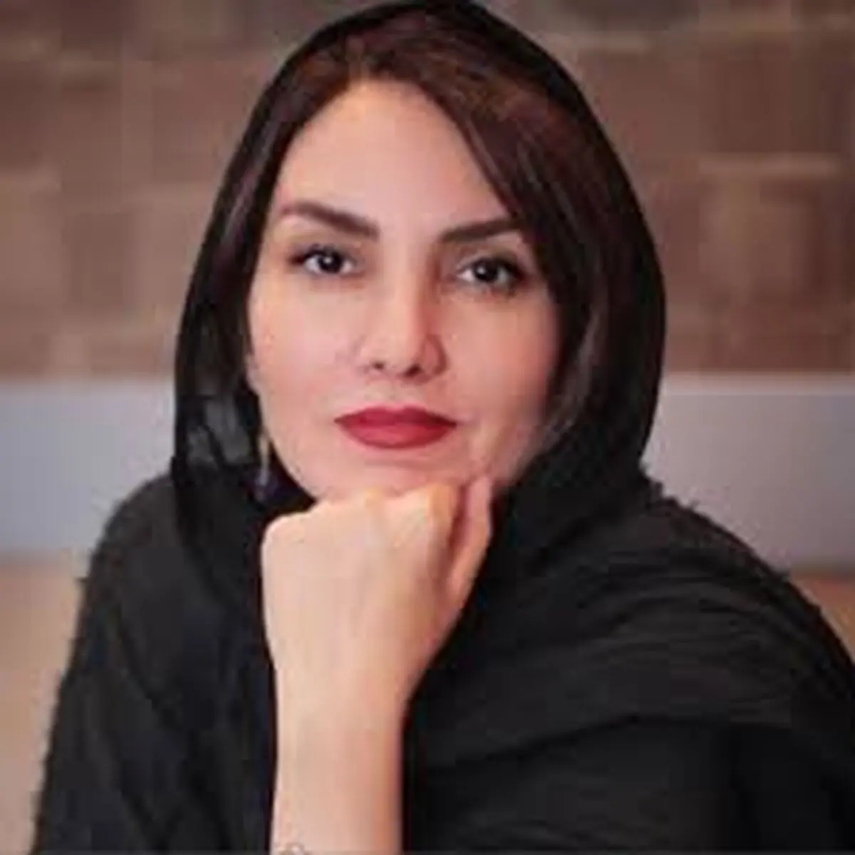 زخمی شدن سر بازیگر معروف / عکس