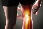 همه چیز درباره رباط زانو