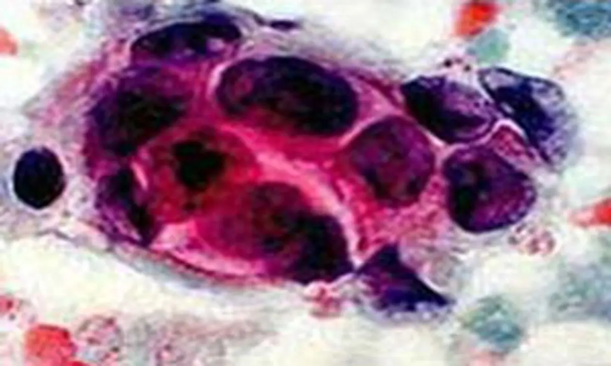 کمبود ۱۰۰ هزار تخت‌ بیمارستانی در کشور