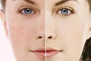 این کارها پوستتان را پیر می کند