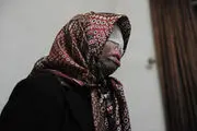 همسرکشی با اسید به خاطر سوء ظن