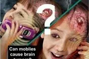 اشعه تلفن همراه و تومورهای مغزی