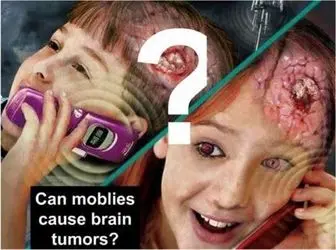 اشعه تلفن همراه و تومورهای مغزی