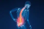 
نشانه پوکی استخوان چیست؟
