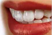 عادتی که دندان‌ها را خراب می‌کند