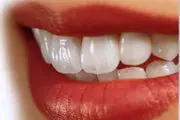 عادتی که دندان‌ها را خراب می‌کند