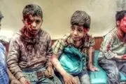 هشدار سازمان ملل درمورد اوضاع کودکان یمن
