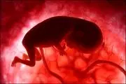  نقش سونوگرافی در شناسایی ناهنجاری‌های جنین در دوران بارداری