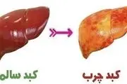 این میوه خوشمزه هم کبد چرب را درمان می‌کند هم باعث طول عمر می‌شود

