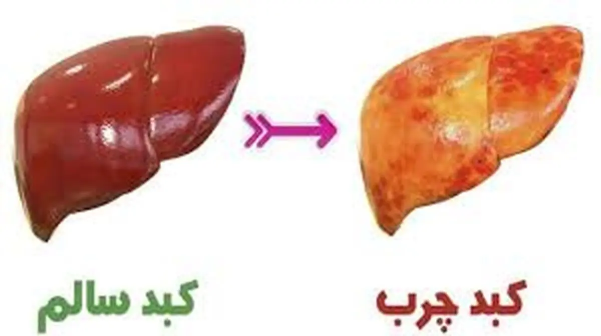 این میوه خوشمزه هم کبد چرب را درمان می‌کند هم باعث طول عمر می‌شود


