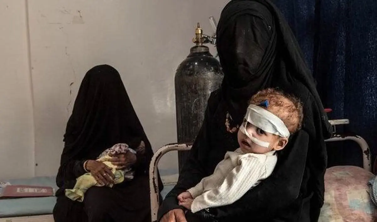 گسترش بیماریهای واگیردار و هشدار سازمان ملل درباره اوضاع بهداشتی یمن