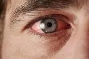 دیابت چه اثری روی  چشم‌ها دارد؟ 