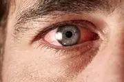 علائمی که نشان دهنده ضعیفی چشم هستند