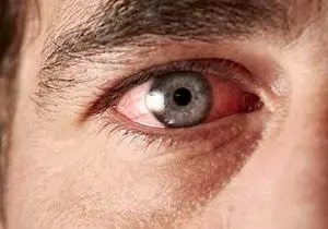 دیابت چه اثری روی  چشم‌ها دارد؟ 