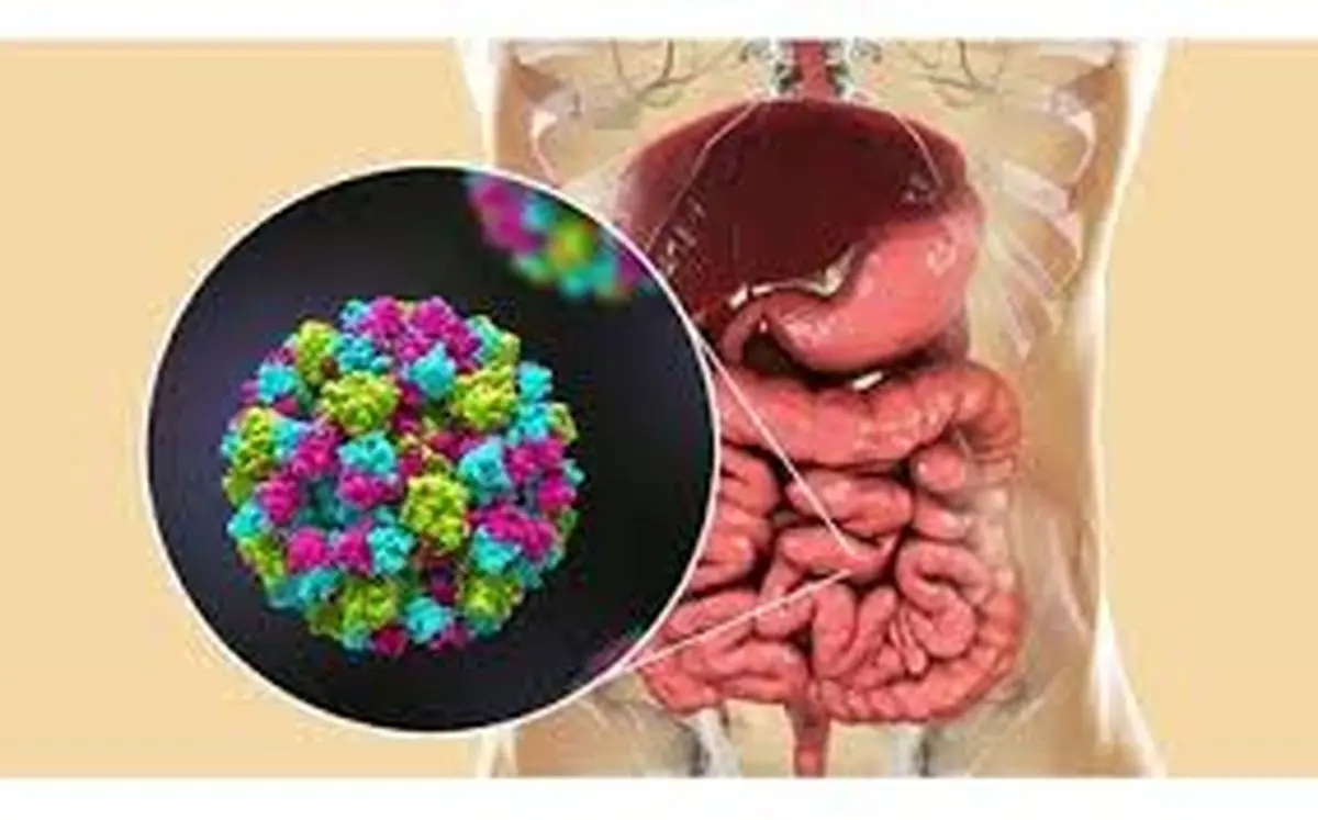 از آنفلوآنزای معده چقدر میدانید؟