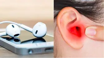 اگر هنگام استفاده از ایرپاد گوش درد میگیرید، بخوانید